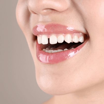 Closeup smile with a tooth gap