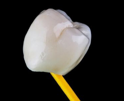 A dental crown